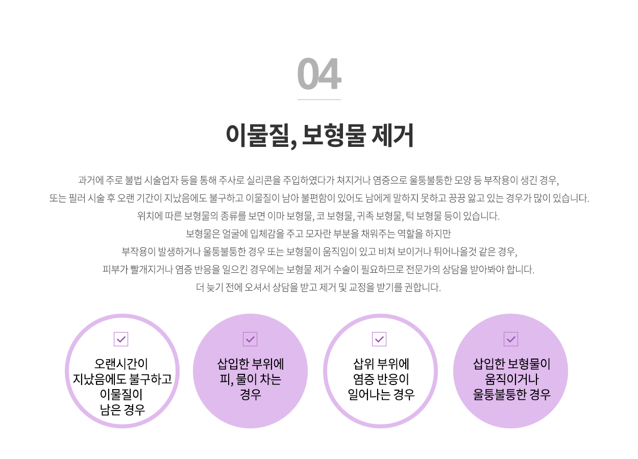 이물질제거
