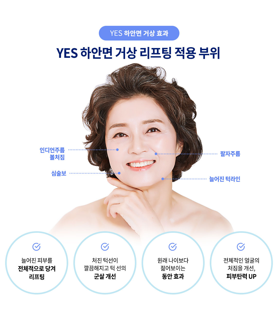 하안면거상 효과 부위