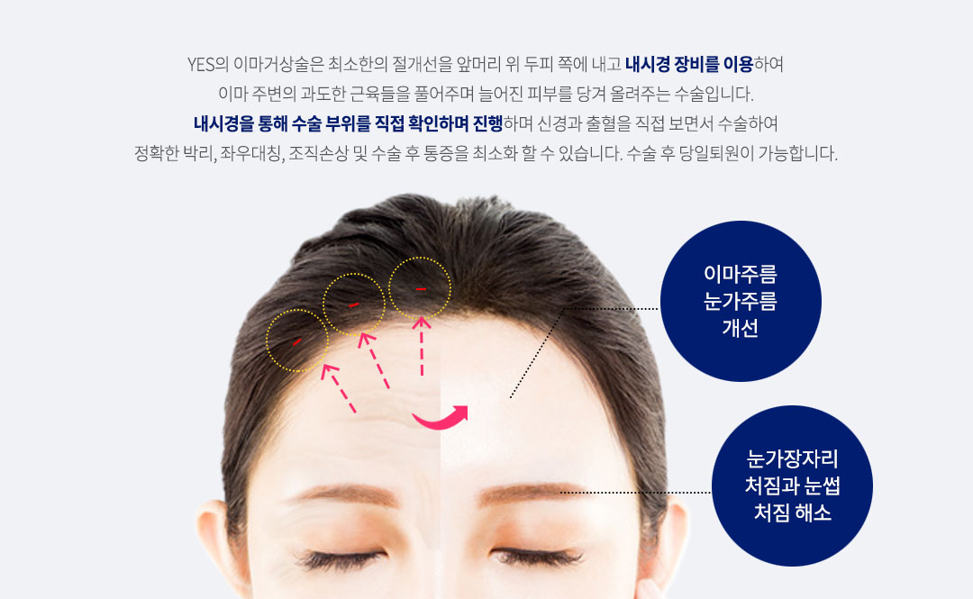 내시경 이마거상 원리
