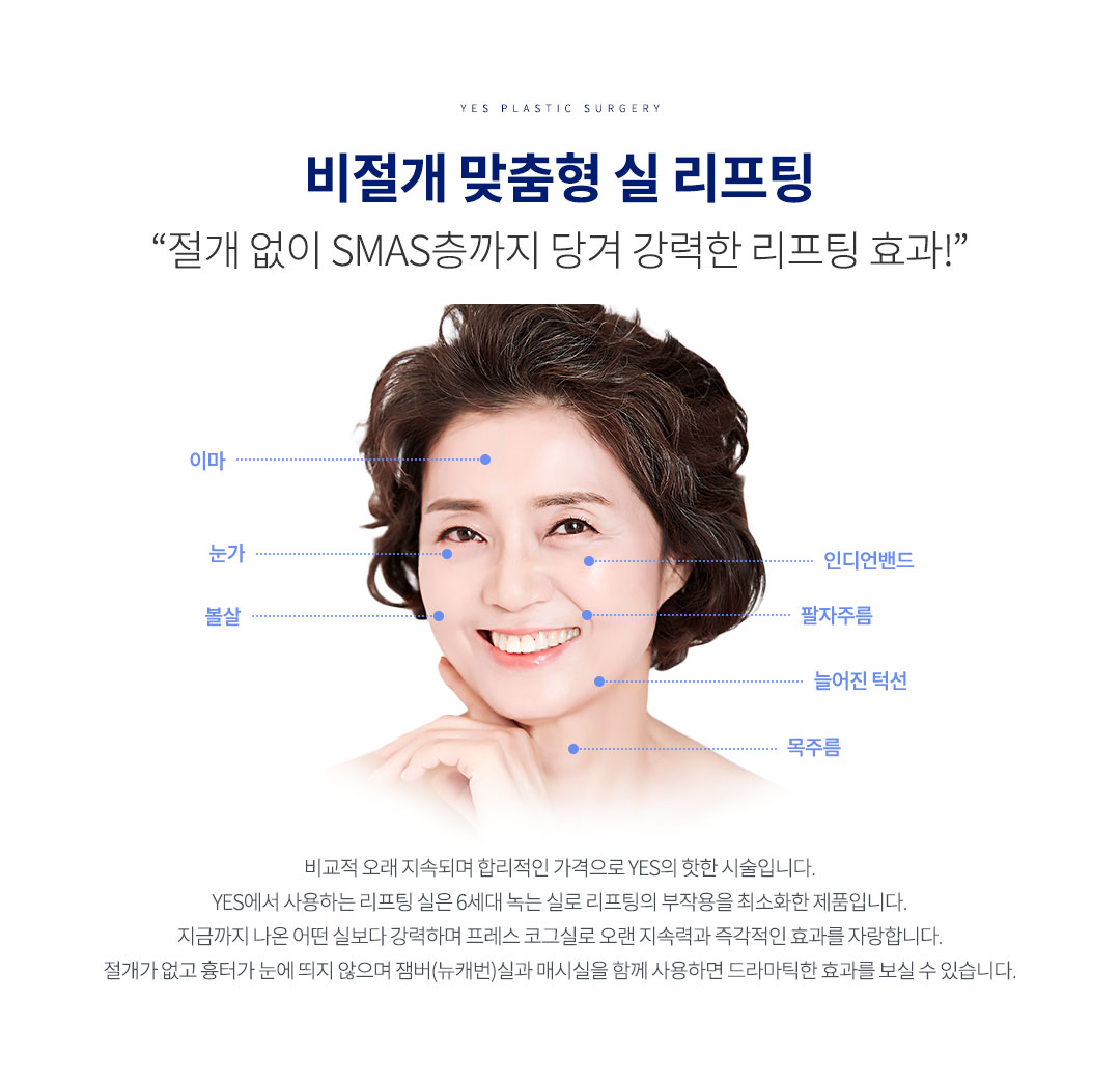 실리프팅