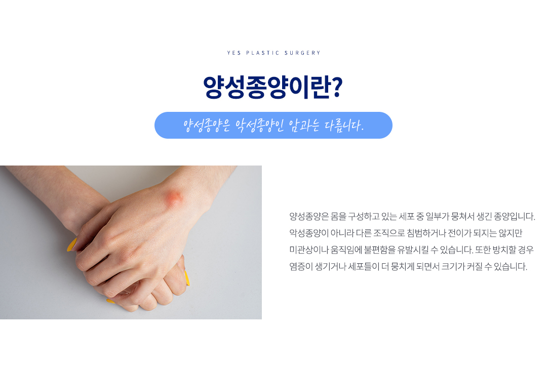 양성종양이란?