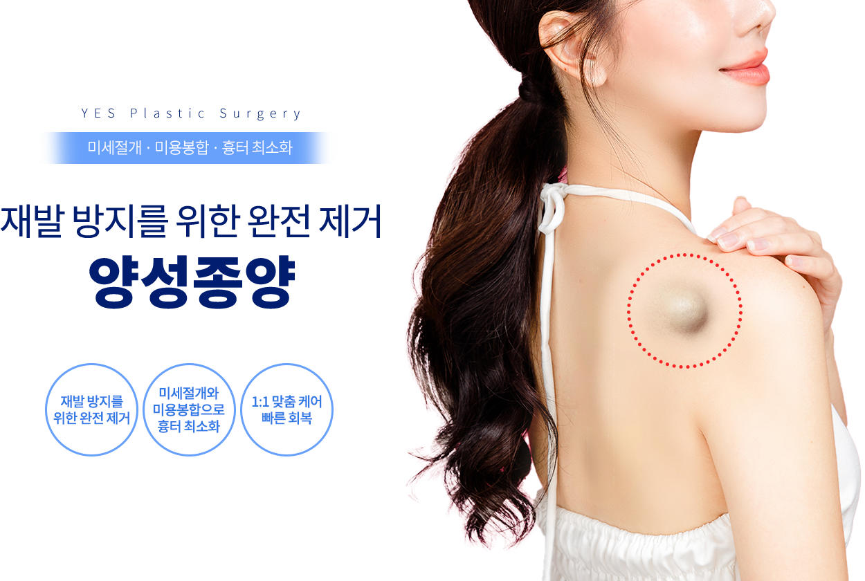 양성종양